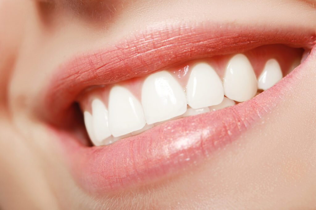 5 Common Cosmetic Procedures to Enhance the Beauty of Your Smile
