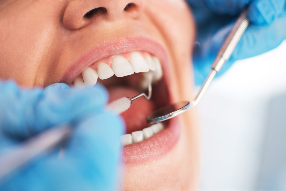 Connection Between Dental Health and Heart Health- Learn Here!