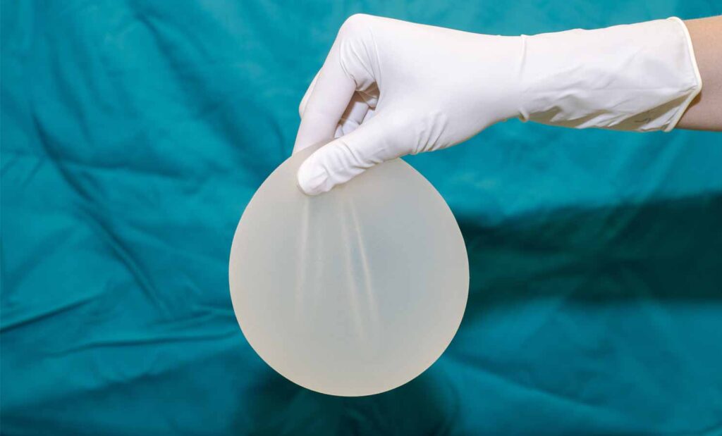 Facts About Gummy Bear Implants that You Need to Know