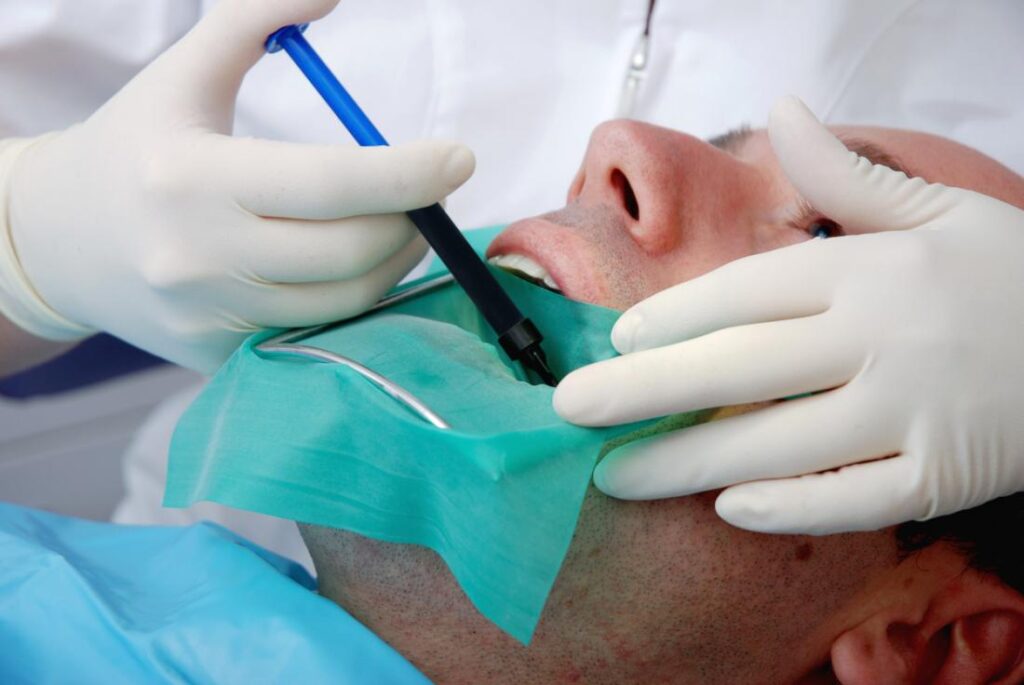 What should I not do after a root canal procedure?