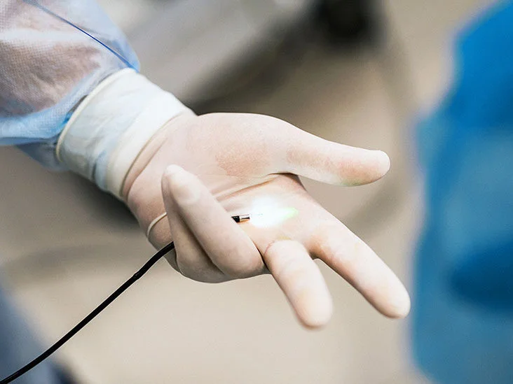 Understanding the Progression of Colon Cancer: Mild Symptoms to Advanced Stages