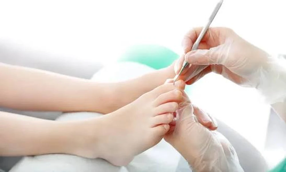 Ingrown Toenail Treatment in Hamilton: When to Seek Professional Foot Care