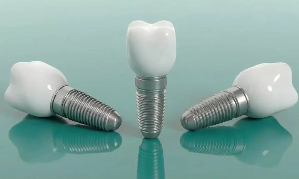 All-on-4 Dental Implants Price in Antalya, Turkey