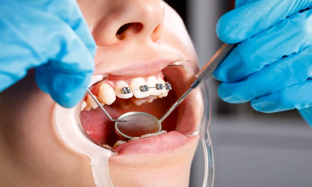 How Periodontists Restore Smiles Through Advanced Care