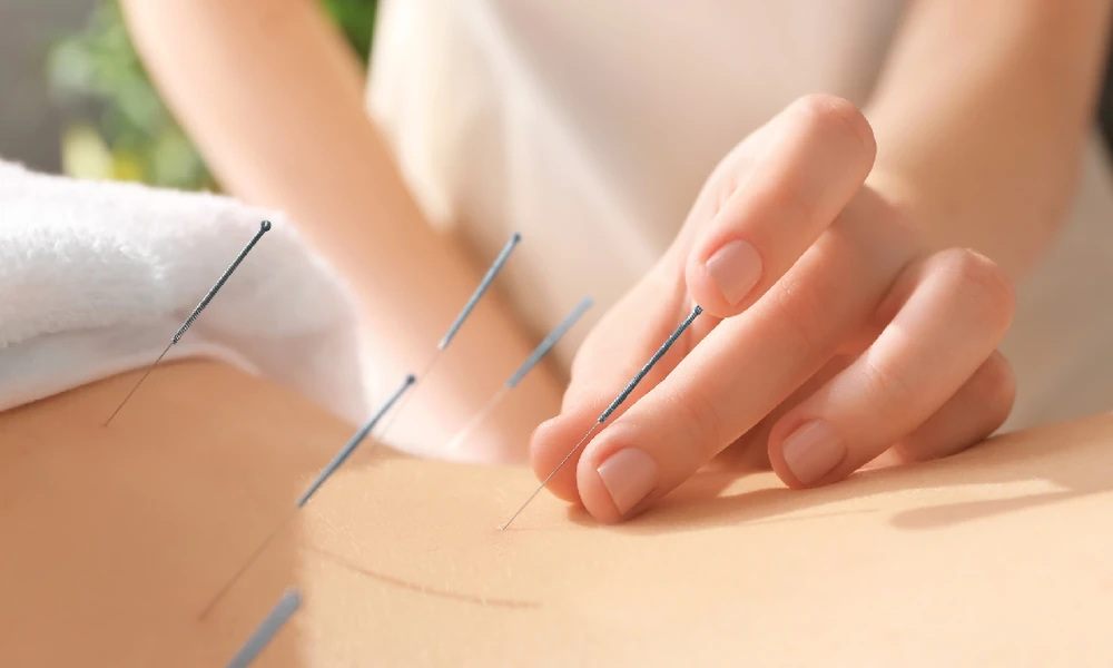 How Many TCM Sessions Pain Relief Usually Takes in Singapore